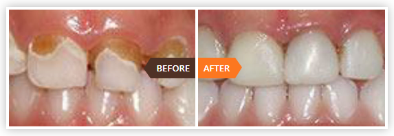 paediatric dentist near me