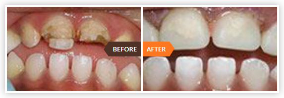 paediatric dentist near me
